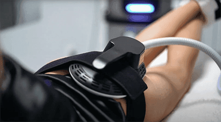 treatment-esculpt
